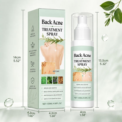 BacneAway™ Skin Spray
