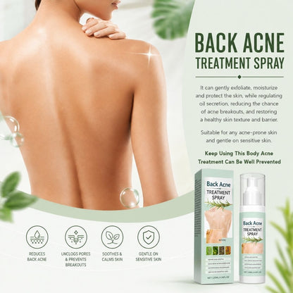 BacneAway™ Skin Spray