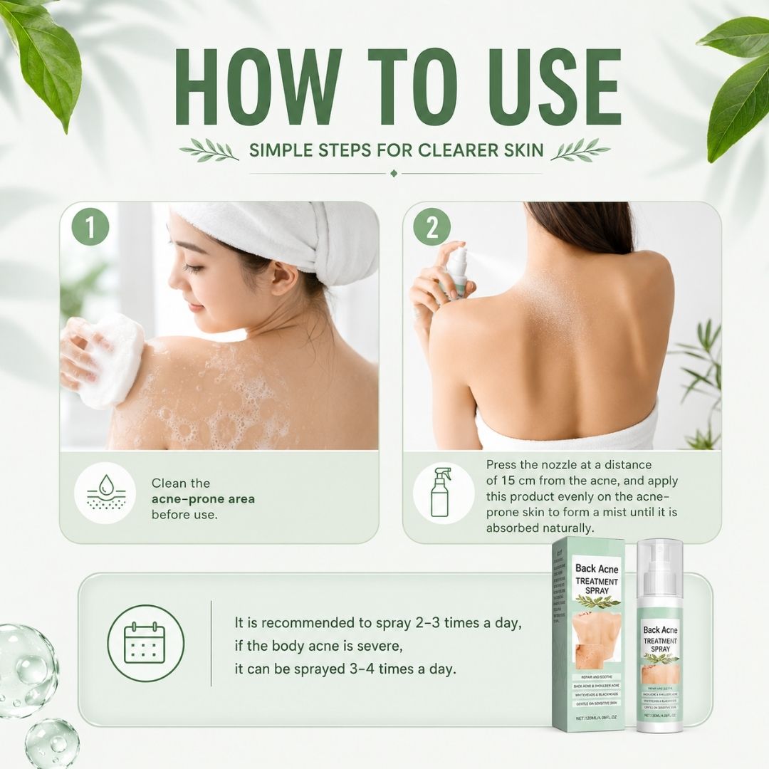BacneAway™ Skin Spray
