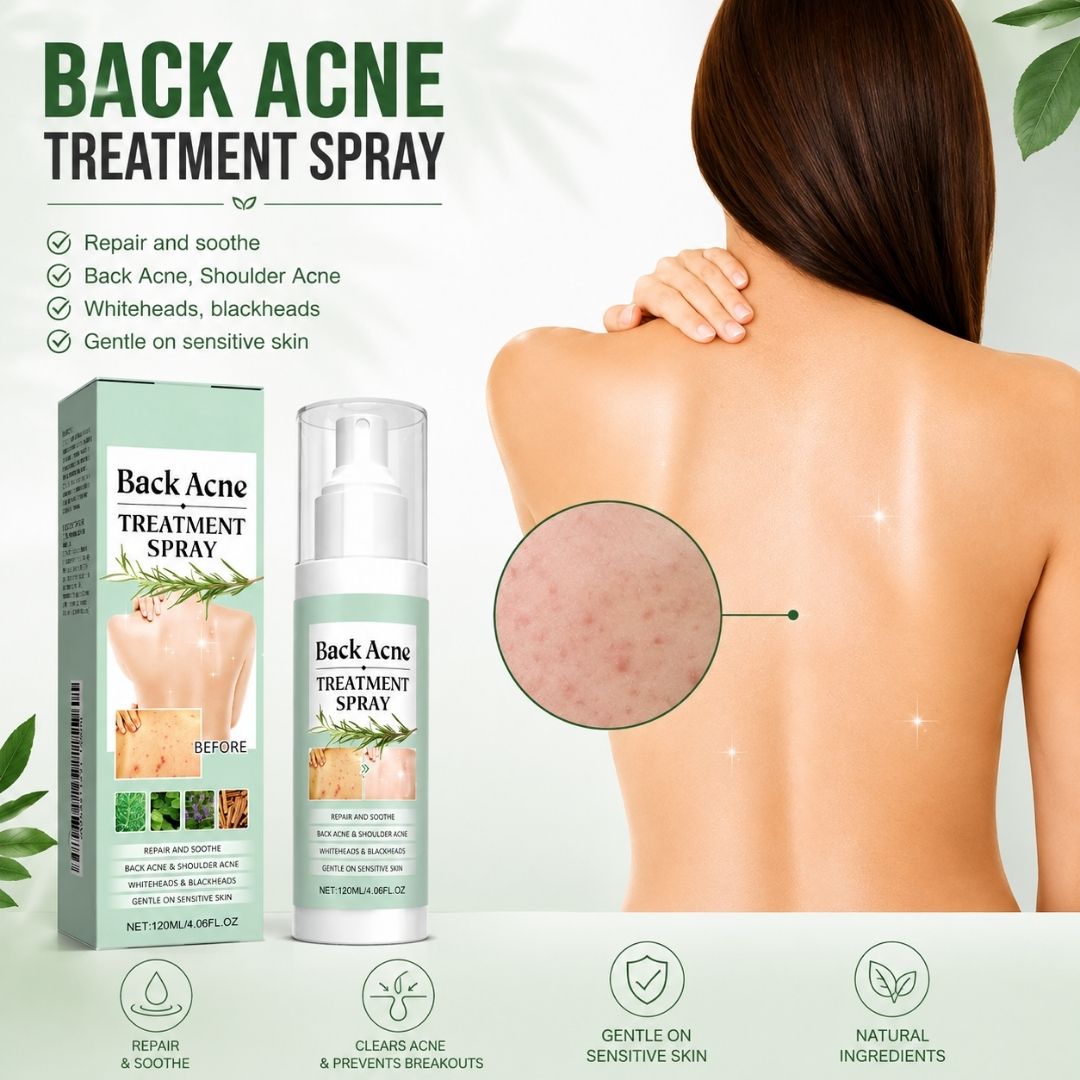 BacneAway™ Skin Spray